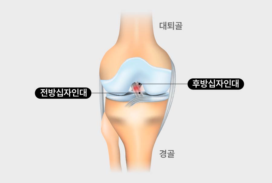 m cm 대지 1